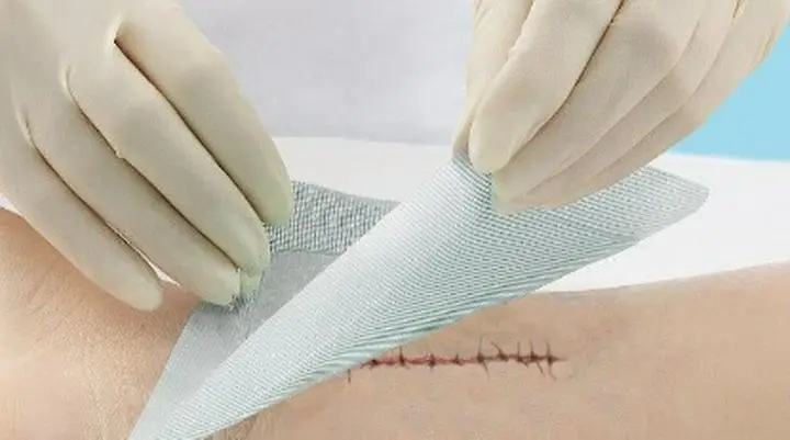 Incision　/ɪnˈsɪʒ.ən/（名詞）　鋭利なものでの切り口。手術の切り口。an opening that is made in something with a sharp tool, especially in someone