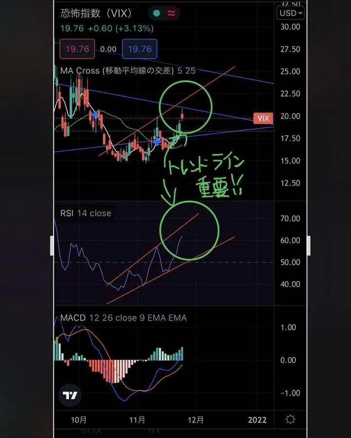 【VIX】注視ですよーー！！